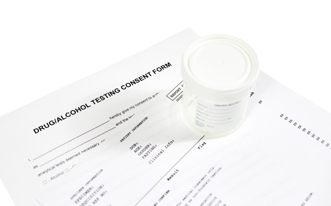 How Long Does Alcohol Stay in Urine? The Answer Revealed